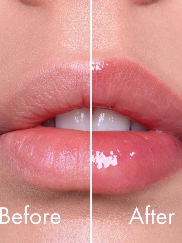 Reedle Shot Expert Lip Plumper - VT Cosmetics