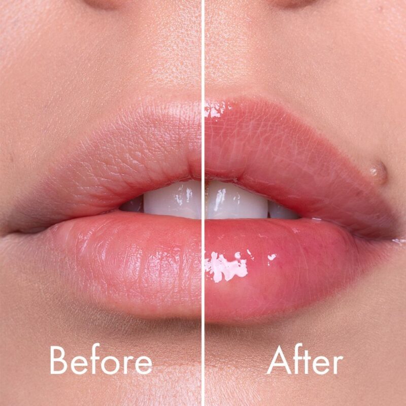 Reedle Shot Expert Lip Plumper - VT Cosmetics