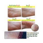 Exfoliante para pies 4 pares | Witch Piggy Hell-Pore Turtles Foot Pack - Elizavecca - Imagen 3